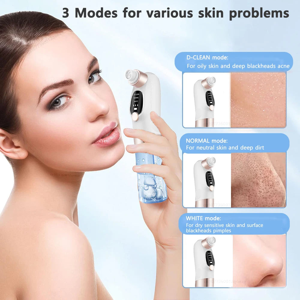 Pore Vacuum Cleaner Blackhead Remover